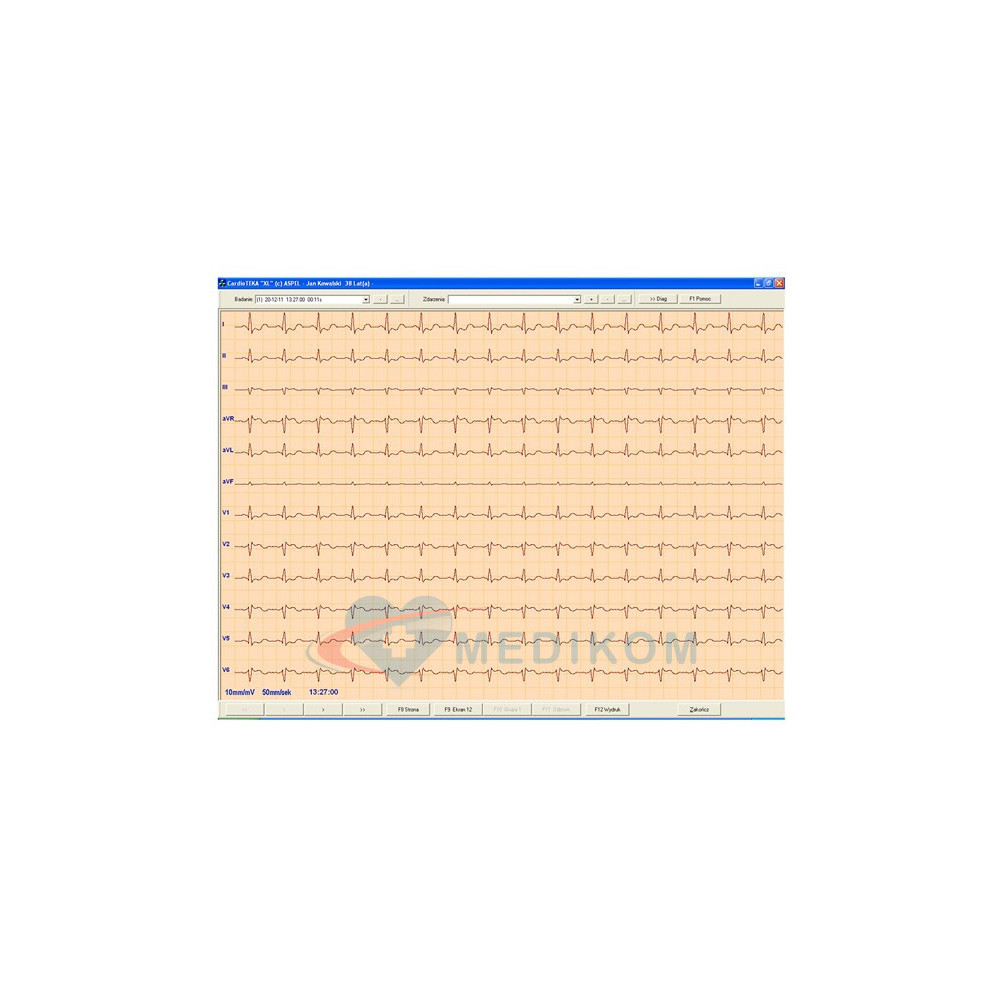 ASPEL ECG CARDIOTEKA v.211SOFT