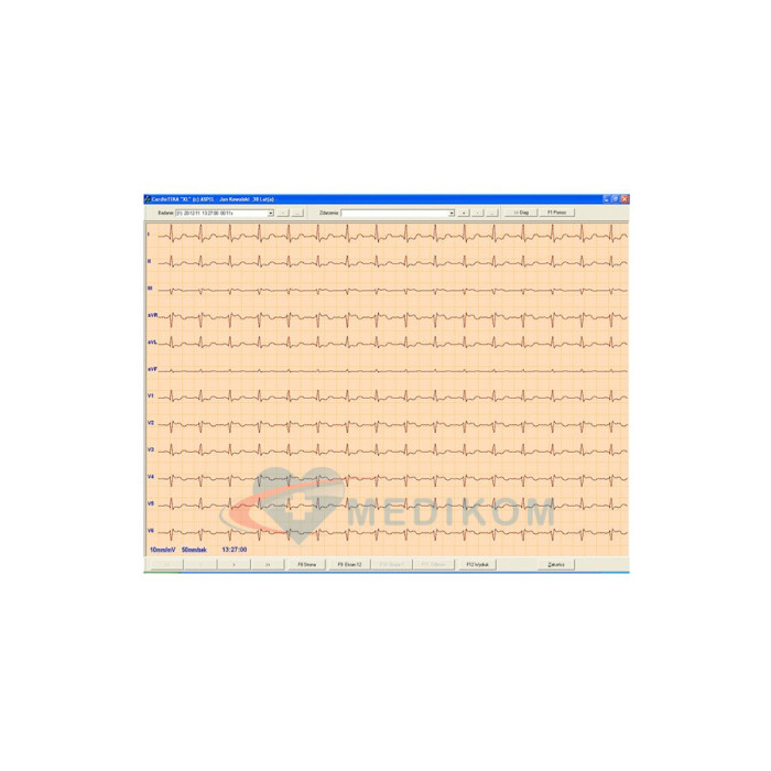 ASPEL ECG CARDIOTEKA v.211SOFTHL7